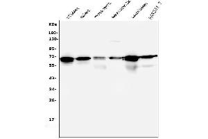 Western blot analysis of AIF using anti-AIF antibody (ABIN6719266).