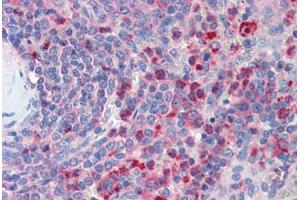 Human Spleen (formalin-fixed, paraffin-embedded) stained with CXCR4 antibody ABIN461996 at 5 ug/ml followed by biotinylated anti-goat IgG secondary antibody ABIN481715, alkaline phosphatase-streptavidin and chromogen. (CXCR4 抗体  (AA 14-40))
