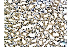 Formalin-fixed and paraffin embedded rat kidney tissue labeled with Anti-Laminin alpha 5 Polyclonal Antibody, Unconjugated (ABIN737451) followed by conjugation to the secondary antibody and DAB staining (Laminin alpha 5 抗体  (AA 301-400))