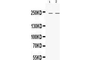Western blot analysis of Nestin expression in HELA whole cell lysates (lane 1) and HEPG2 whole cell lysates (lane 2).