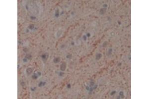 IHC-P analysis of Human Tissue, with DAB staining. (TWF1 抗体  (AA 1-252))