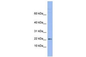 Image no. 1 for anti-Ribosomal Protein S24 (RPS24) (AA 71-120) antibody (ABIN6742964) (RPS24 抗体  (AA 71-120))
