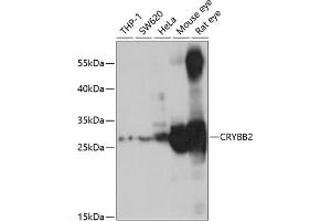 Western blot analysis of extracts of various cell lines, using CRYBB2 antibody (ABIN6130971, ABIN6139077, ABIN6139078 and ABIN6221220) at 1:1000 dilution. (CRYbB2 抗体  (AA 1-205))