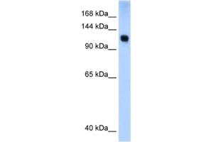 Western Blotting (WB) image for anti-SWI/SNF Related, Matrix Associated, Actin Dependent Regulator of Chromatin, Subfamily A, Member 5 (SMARCA5) antibody (ABIN2460151) (SMARCA5 抗体)