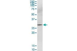 HOXB9 MaxPab rabbit polyclonal antibody. (HOXB9 抗体  (AA 1-250))