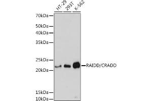 Western blot analysis of extracts of various cell lines, using RAIDD/CRADD Rabbit mAb (ABIN7266106) at 1:3000 dilution. (CRADD 抗体)