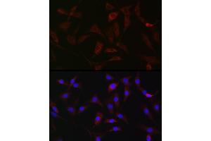 Immunofluorescence analysis of NIH/3T3 cells using [KO Validated] HK1 Rabbit pAb (ABIN3021308, ABIN3021309, ABIN3021310 and ABIN6214823) at dilution of 1:50 (40x lens). (Hexokinase 1 抗体  (AA 20-300))