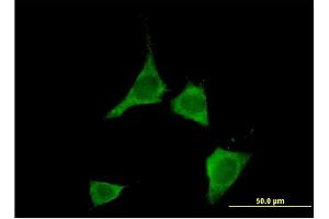 Immunofluorescence (IF) image for anti-Calcium/calmodulin-Dependent Protein Kinase II delta (CAMK2D) (AA 301-410) antibody (ABIN513980)