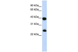H2AFY antibody used at 1 ug/ml to detect target protein. (H2AFY 抗体  (Middle Region))