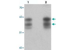 Western blot analysis of NSRP1 in human brain tissue with NSRP1 polyclonal antibody  at (lane 1) 0. (NSRP1 抗体  (C-Term))
