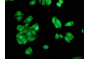 Immunofluorescence staining of HepG2 cells with ABIN7157138 at 1:66, counter-stained with DAPI. (IST1 抗体  (AA 172-284))