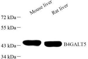 Western blot analysis of B4GALT5 (ABIN7076138) at dilution of 1: 1000 (B4GALT5 抗体)
