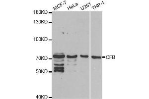 Western blot analysis of extracts of various cell lines, using CFB antibody. (Complement Factor B 抗体  (AA 80-420))