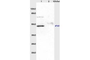 Lane 1: rat brain lysates Lane 2: human colon carcinoma lysates probed with Anti KIST/UHMK1 Polyclonal Antibody, Unconjugated (ABIN716516) at 1:200 in 4 °C.