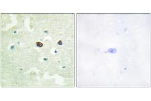 Immunohistochemistry (IHC) image for anti-Protein tyrosine Phosphatase, Non-Receptor Type 1 (PTPN1) (AA 16-65), (pSer50) antibody (ABIN1531514)