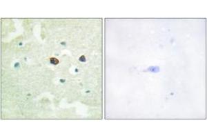 Immunohistochemistry analysis of paraffin-embedded human brain, using PTP1B (Phospho-Ser50) Antibody. (PTPN1 抗体  (pSer50))