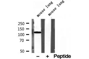 Western blot analysis of extracts of mouse lung tissue, using OGDH antibody. (alpha KGDHC 抗体  (N-Term))