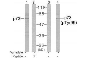 Image no. 1 for anti-Tumor Protein P73 (TP73) (Tyr99) antibody (ABIN197232) (Tumor Protein p73 抗体  (Tyr99))