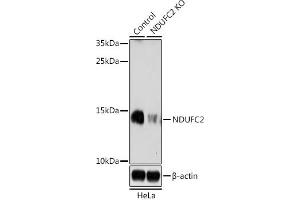 Western Blotting (WB) image for anti-NADH Dehydrogenase (Ubiquinone) 1, Subcomplex Unknown, 2, 14.5kDa (NDUFC2) (AA 1-100) antibody (ABIN7268818)