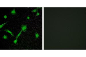 P-peptide - +Immunofluorescence analysis of LOVO cells, using IκB-α (Phospho-Ser32/Ser36) antibody. (NFKBIA 抗体  (pSer32, pSer36))