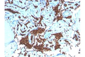 Formalin-fixed, paraffin-embedded human Placenta stained with Glycophorin A Recombinant Rabbit Monoclonal Antibody (GYPA/3219R). (Recombinant CD235a/GYPA 抗体)