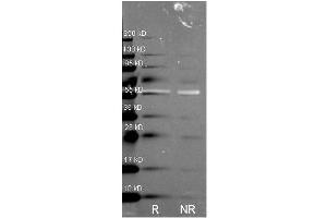 Catalase antibody was used to detect Catalase under reducing (R) and non-reducing (NR) conditions. (Catalase 抗体)