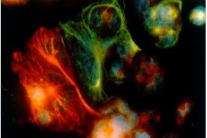 Image no. 1 for anti-Keratin 18 (KRT18) antibody (ABIN335330) (Cytokeratin 18 抗体)