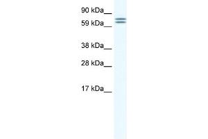 WB Suggested Anti-CES6 Antibody Titration:  1. (CES4A 抗体  (Middle Region))