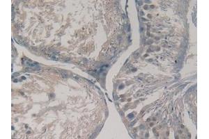 Immunohistochemistry (IHC) image for anti-Gremlin 1 (GREM1) (AA 26-184) antibody (ABIN7434692)
