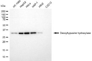anti-Deoxyhypusine Hydroxylase/monooxygenase (DOHH) antibody