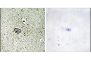 Immunohistochemistry analysis of paraffin-embedded human brain tissue, using PDGFR alpha (Ab-762) Antibody. (PDGFRA 抗体  (AA 731-780))
