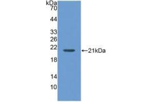 Western blot analysis of recombinant Human MGA. (AGLU 抗体  (AA 213-392))