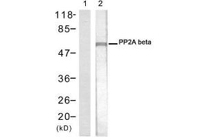 Western blot analysis of extracts from 293 cells using PP2A-beta antibody (E021404, Lane 1 and 2). (PPP2CB 抗体)