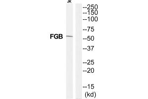Western Blotting (WB) image for anti-Fibrinogen beta Chain (FGB) (C-Term) antibody (ABIN1852788) (Fibrinogen beta Chain 抗体  (C-Term))