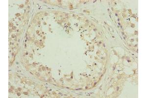 Immunohistochemistry of paraffin-embedded human testis tissue using ABIN7176441 at dilution of 1:100 (ZNF622 抗体  (AA 2-280))