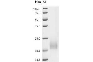 (Tris-Glycine gel) Discontinuous SDS-PAGE (reduced) with 5 % enrichment gel and 15 % separation gel.