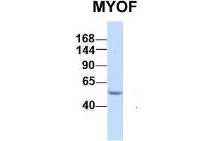 Western Blotting (WB) image for anti-Myoferlin (MYOF) (C-Term) antibody (ABIN2782797)