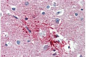 Human Brain, Cortex, Senile Plaque (formalin-fixed, paraffin-embedded) stained with HMGN1 antibody ABIN462182 followed by biotinylated goat anti-rabbit IgG secondary antibody ABIN481713, alkaline phosphatase-streptavidin and chromogen. (HMGN1 抗体  (AA 36-85))