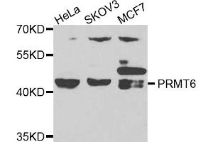 Western blot analysis of extracts of various cell lines, using PRMT6 antibody. (PRMT6 抗体)