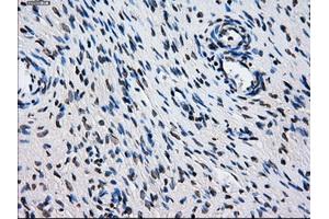 Immunohistochemical staining of paraffin-embedded colon tissue using anti-L1CAMmouse monoclonal antibody. (L1CAM 抗体)