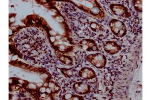 Immunohistochemistry (IHC) image for anti-Topoisomerase (DNA) I (TOP1) antibody (ABIN7127850)