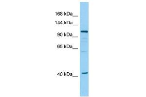 Host: Rabbit Target Name: DHTKD1 Sample Type: 293T Whole Cell lysates Antibody Dilution: 1. (DHTKD1 抗体  (N-Term))