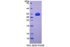 SDS-PAGE analysis of Human GDF11 Protein. (GDF11 蛋白)