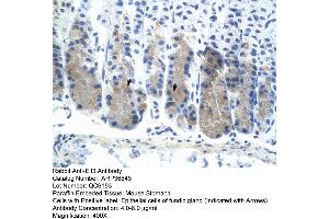 Immunohistochemistry (IHC) image for anti-E74-Like Factor 3 (Ets Domain Transcription Factor, Epithelial-Specific) (ELF3) (N-Term) antibody (ABIN2779832)