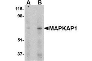 Western Blotting (WB) image for anti-Mitogen-Activated Protein Kinase Associated Protein 1 (MAPKAP1) (Middle Region) antibody (ABIN1030995) (MAPKAP1 抗体  (Middle Region))