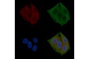 ABIN6260435 and ABIN6272263 staining Hela cells(24h of starvation treatment) by IF/ICC. (CaMK2 beta/gamma 抗体  (C-Term))