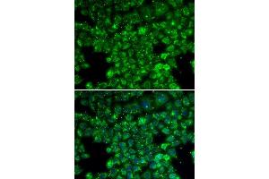 Immunofluorescence analysis of U20S cell using LYZL6 antibody. (LYZL6 抗体  (AA 20-148))