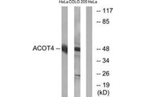 Western blot analysis of extracts from HeLa/COLO cells, using ACOT4 Antibody. (ACOT4 抗体  (AA 361-410))