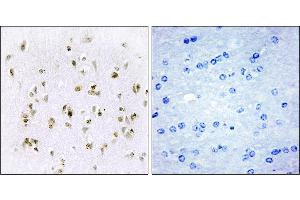 Immunohistochemistry analysis of paraffin-embedded human brain tissue, using HMG17 antibody. (HMGN2 抗体)