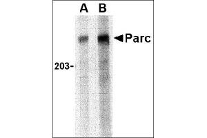 Western blot analysis of PARC in Daudi lysate with this product at (A) 1 and (B) 2 μg/ml. (CUL9 抗体  (C-Term))